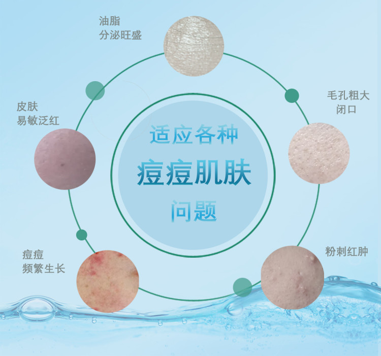 3 祛痘膏.jpg